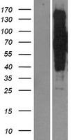 SIK3 Human Over-expression Lysate