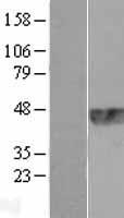 TRIB1 Human Over-expression Lysate