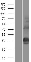 CSP (DNAJC5) Human Over-expression Lysate