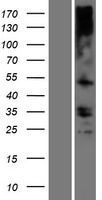 TMEM121 Human Over-expression Lysate