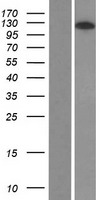 KIAA1688 (ARHGAP39) Human Over-expression Lysate