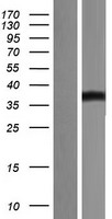 B7H3 (CD276) Human Over-expression Lysate