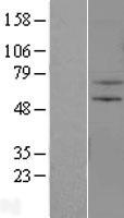 ZNF34 Human Over-expression Lysate
