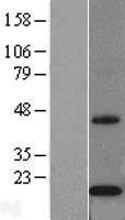 Cytochrome b5 Outer Mitochondrial Membrane (CYB5B) Human Over-expression Lysate