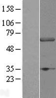 WDR23 (DCAF11) Human Over-expression Lysate