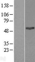PNPLA3 Human Over-expression Lysate