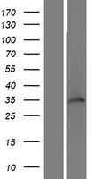 WDR82 Human Over-expression Lysate