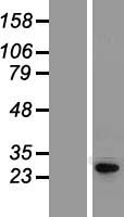 KCNIP4 Human Over-expression Lysate