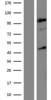 JHDM1D (KDM7A) Human Over-expression Lysate