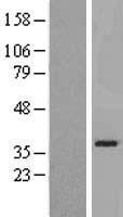 SLC25A21 Human Over-expression Lysate