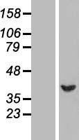 SERPINB1 Human Over-expression Lysate