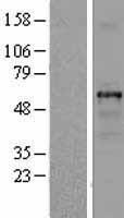 TUBB1 Human Over-expression Lysate