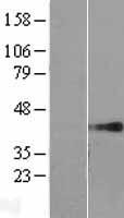 GJA9 Human Over-expression Lysate