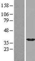 NPL Human Over-expression Lysate