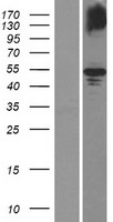 GDPD5 Human Over-expression Lysate