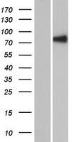 RSPH6A Human Over-expression Lysate