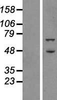 ATG16L1 Human Over-expression Lysate
