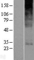 YIPF5 Human Over-expression Lysate