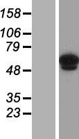 ANKRD13C Human Over-expression Lysate