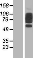 COL21A1 Human Over-expression Lysate