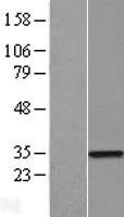ZNF323 (ZSCAN31) Human Over-expression Lysate