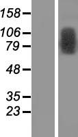 C1orf25 (TRMT1L) Human Over-expression Lysate