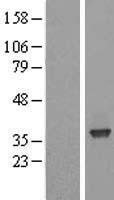 SFXN3 Human Over-expression Lysate