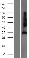 Sprouty 4 (SPRY4) Human Over-expression Lysate