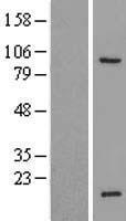 SPACA1 Human Over-expression Lysate