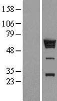 hnRNP K (HNRNPK) Human Over-expression Lysate