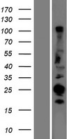 CABP (CABP1) Human Over-expression Lysate