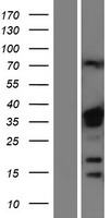 hnRNP A1 (HNRNPA1) Human Over-expression Lysate