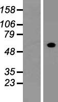 FCRL4 Human Over-expression Lysate