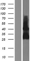 RAB33B Human Over-expression Lysate