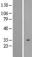 SLC25A31 Human Over-expression Lysate