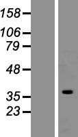 HNRNPC Human Over-expression Lysate