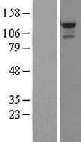 STK31 Human Over-expression Lysate