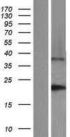 DNAL1 Human Over-expression Lysate