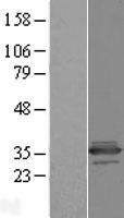 C11orf68 Human Over-expression Lysate