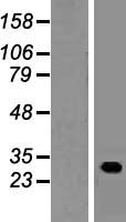 C22orf13 (GUCD1) Human Over-expression Lysate