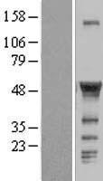 CCM2 Human Over-expression Lysate