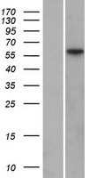 MFRP Human Over-expression Lysate
