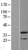 RHNO1 Human Over-expression Lysate