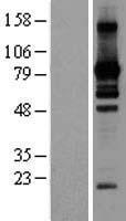 L3MBTL2 Human Over-expression Lysate