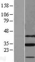 SLC25A18 Human Over-expression Lysate