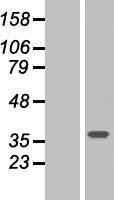 SVH (ARMC10) Human Over-expression Lysate