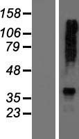AGXT2 Human Over-expression Lysate