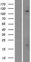 FAM62C (ESYT3) Human Over-expression Lysate