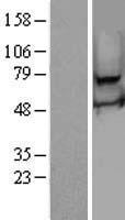 RSPH3 Human Over-expression Lysate