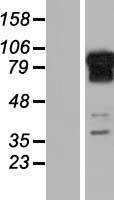 REPS1 Human Over-expression Lysate